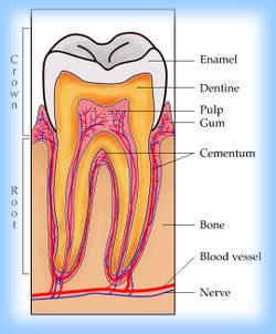 periodontal disease